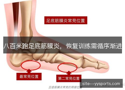 八百米跑足底筋膜炎，恢复训练需循序渐进